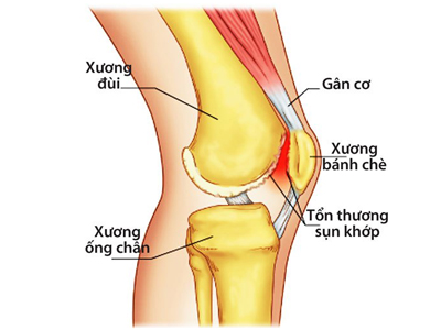 glucosamine la gi