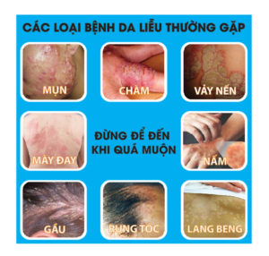 phong kham da lieu o tp hcm