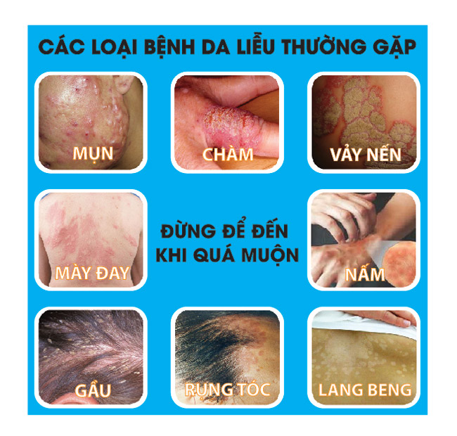 phong kham da lieu o tp hcm