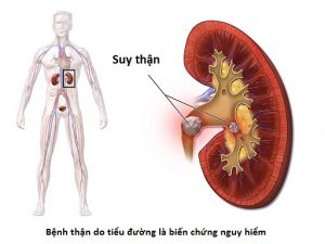 kham than o dau tai hcm