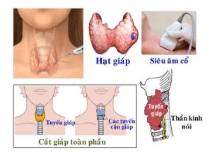 kham tuyen giap