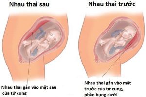 vicare.vn-rau-bam-mat-truoc-la-trai-hay-gai-body-1