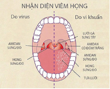 viem hong