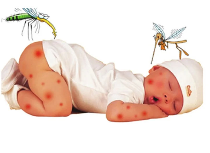 Bệnh ѕốt xuất huyết ở trẻ em và cách điều trị 5 Bệnh ѕốt xuất huyết ở trẻ em và cách điều trị