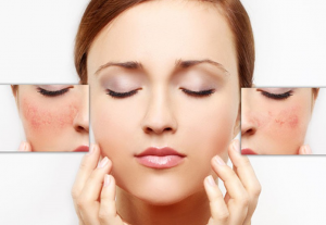 Chia sẻ những loại kem dưỡng ẩm cho da nhạy cảm