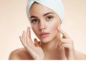 Nguyên tắc về cách tẩy tế bào chết cho da mụn