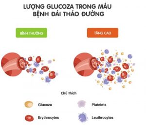 Bệnh đái tháo đường thai kỳ có nguy hiểm không?