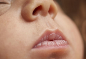 Nguyên nhân và cách chữa trị trẻ sơ sinh bị khô môi