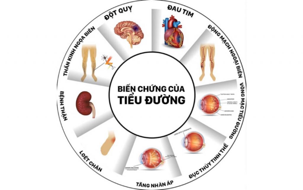 Bệnh tiểu đường ảnh hưởng đến đời sống tình dục ra sao?Bệnh tiểu đường ảnh hưởng đến đời sống tình dục ra sao?