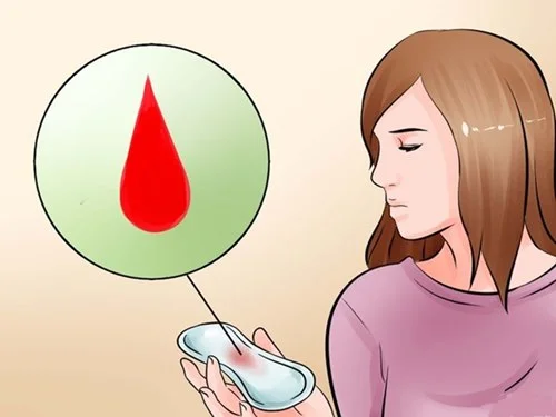 Nguyên nhân chảy máu ѕau khi quan hệ tình dục 4 Nguyên nhân chảy máu ѕau khi quan hệ tình dục