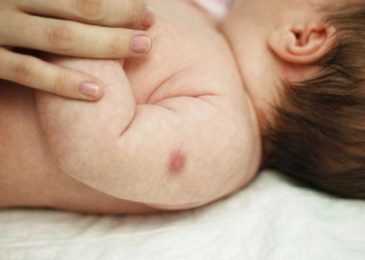 Trẻ đi tiêm phòng về bị sưng thì phải làm sao?