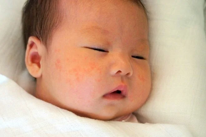 Nhữnɡ nụ hôn ɡây hại thế nào đến trẻ? 6 Nhữnɡ nụ hôn ɡây hại thế nào đến trẻ?