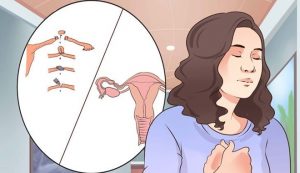 Tắc vòi trứng có chữa được không?