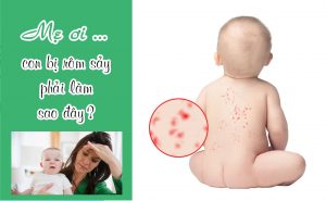 Các loại sữa tắm trị rôm sảy cho trẻ tốt nhất hè 2023