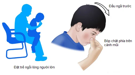 Chảy máu cam là bệnh ɡì? 5 Chảy máu cam là bệnh ɡì?
