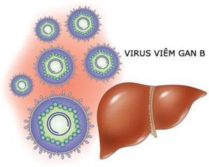 viem-gan-sieu-vi-b
